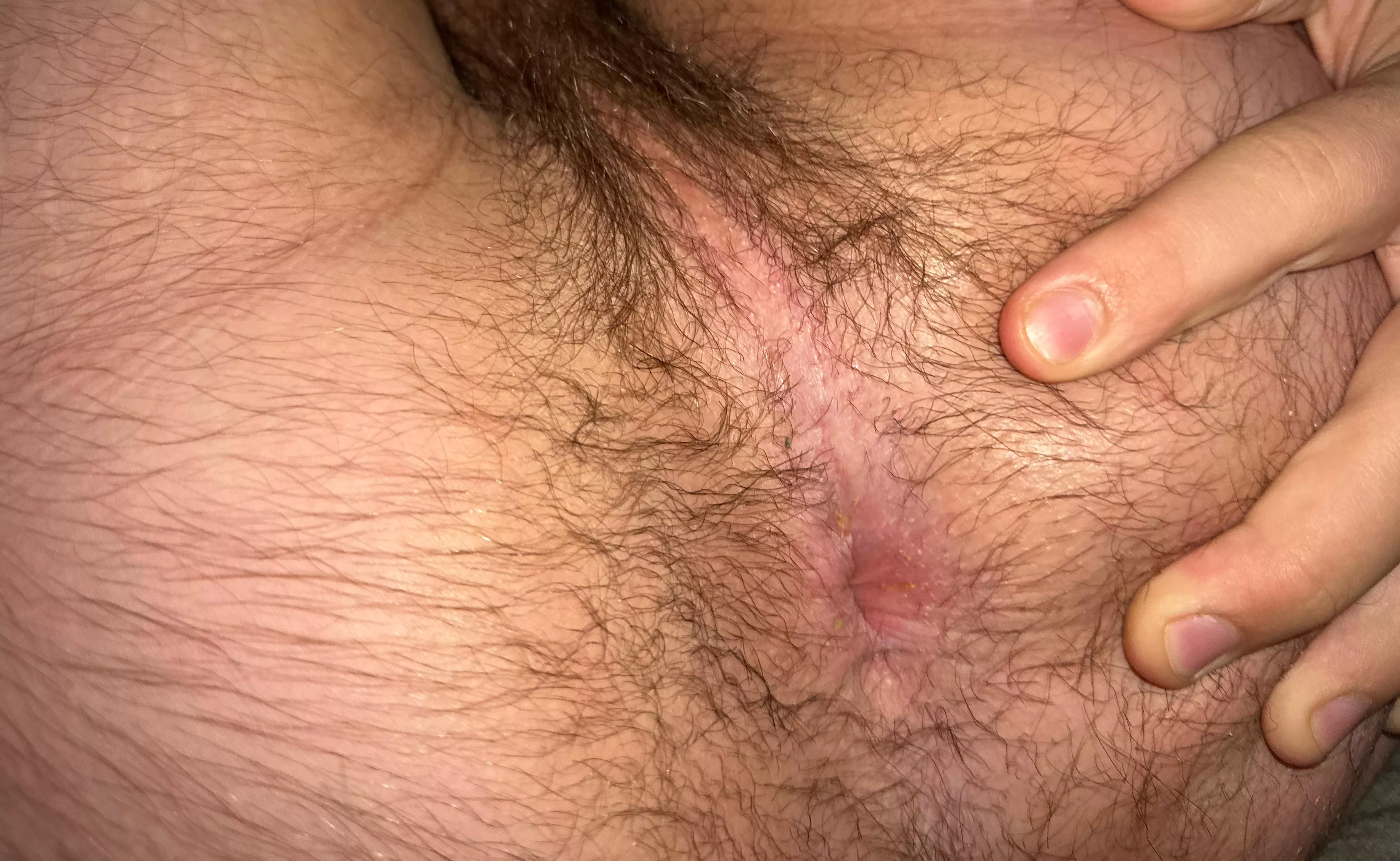 Need somewhere to sit(19)