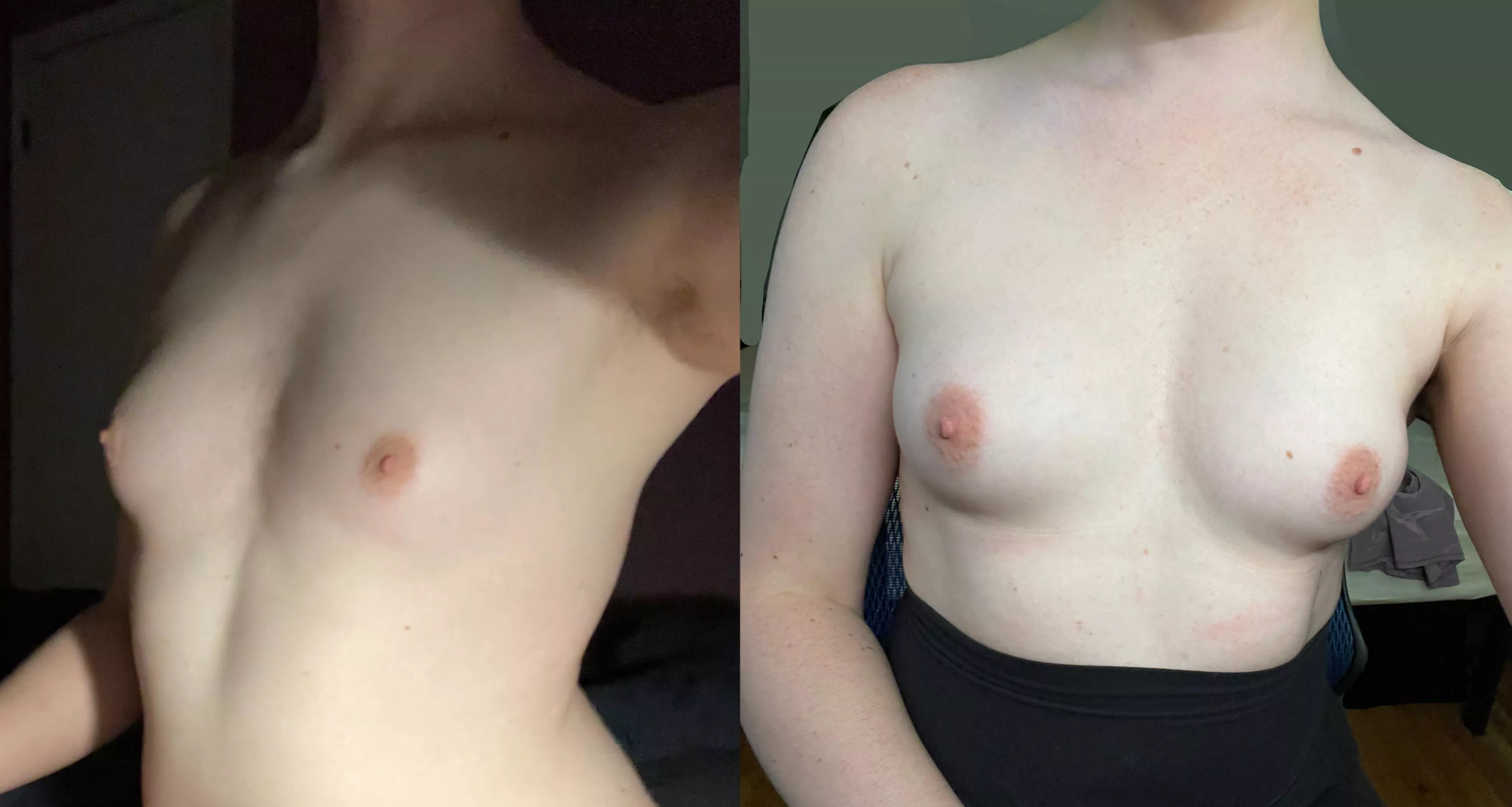 one more to show how they filled out (2yrs difference)