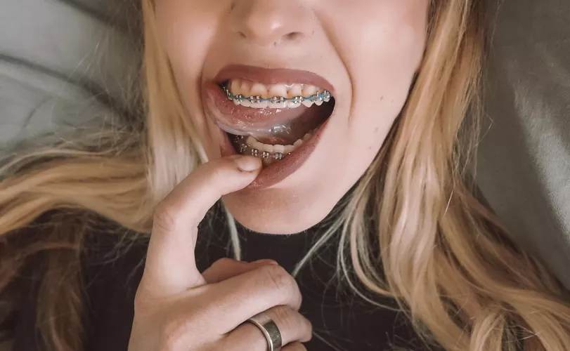 Purple or blue? Oh wait, let me guess… purple and blue covered in white 😝