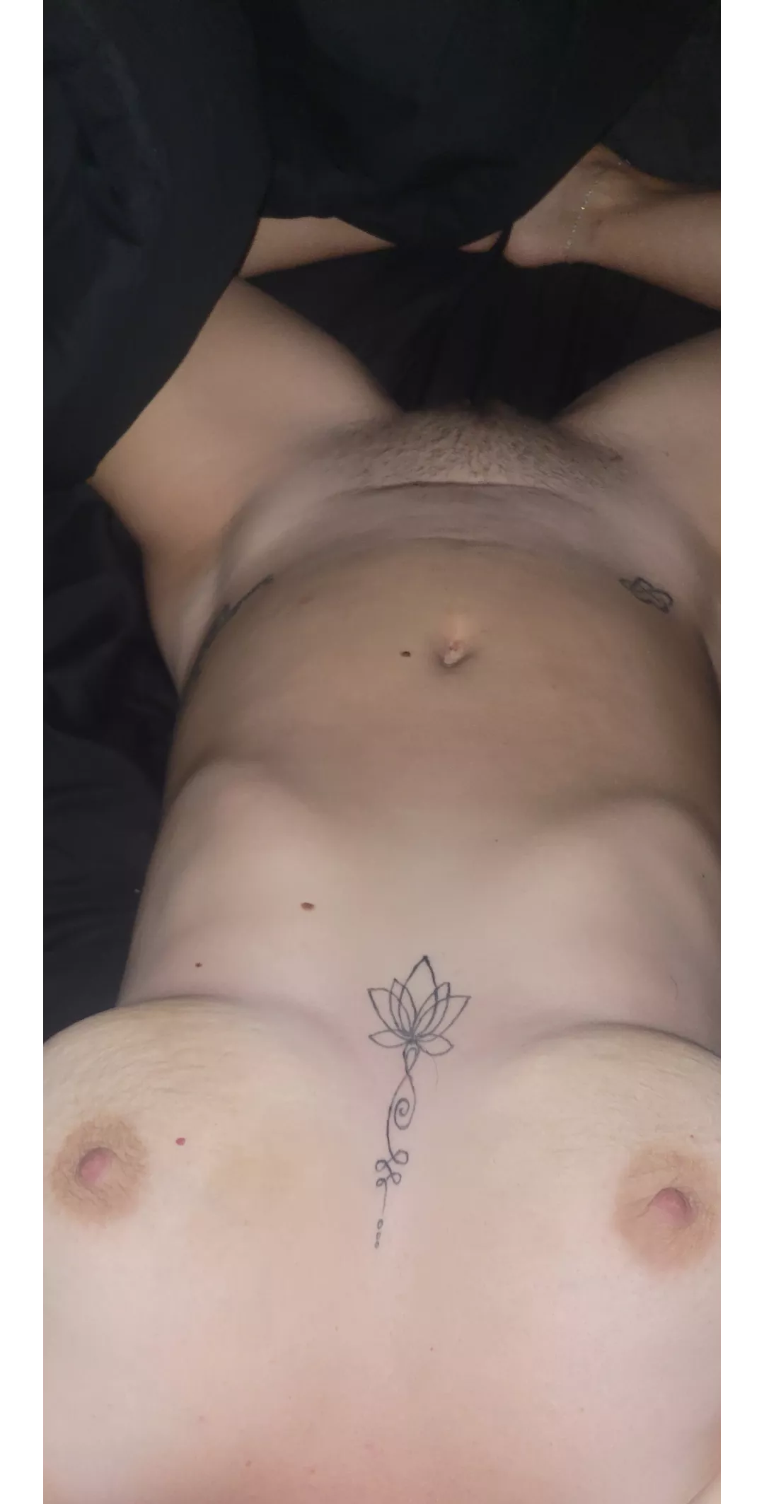 Self conscious of my c section scar. 