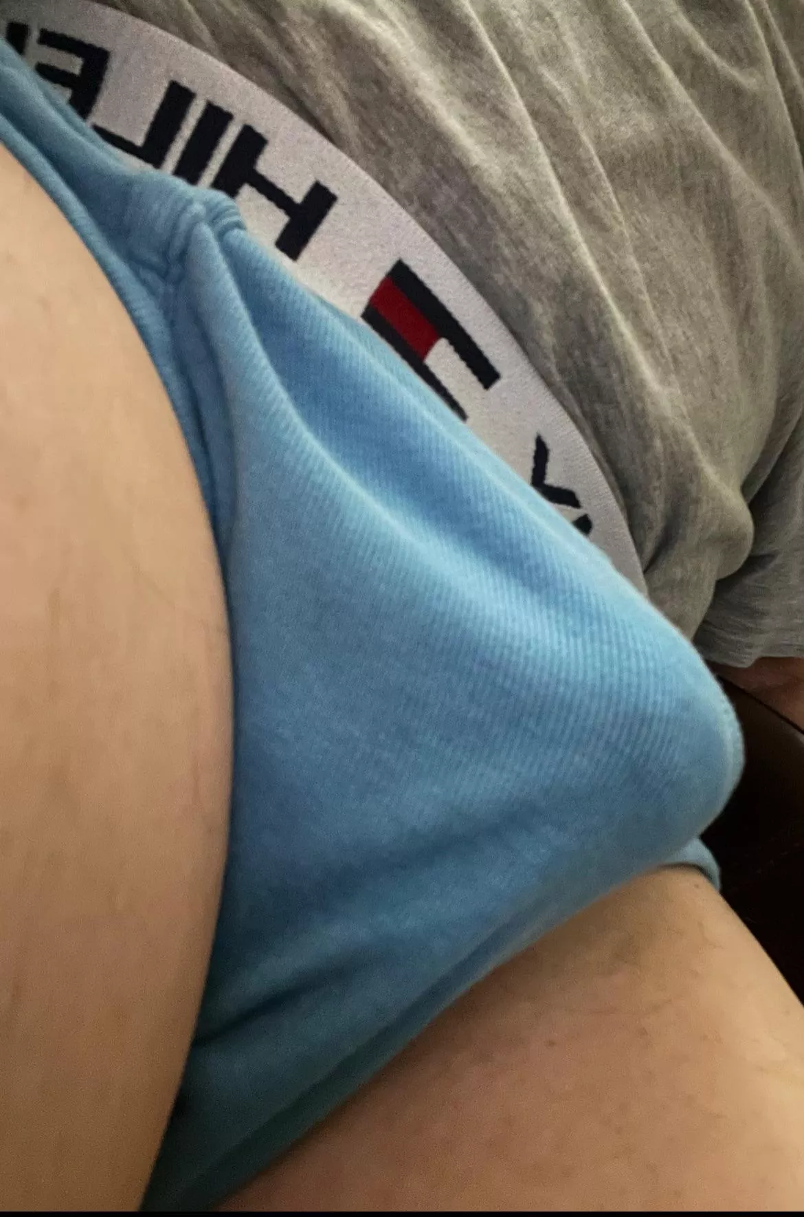 A bulge in Tommy’s