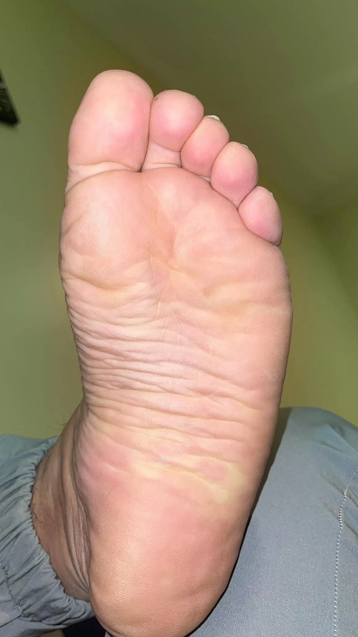 a Turkish Daddys bright soles...