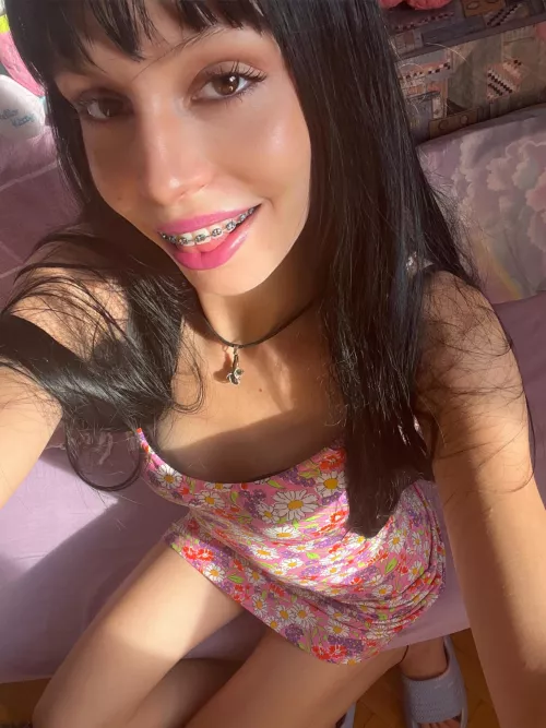 do my braces catch ur attention? :P