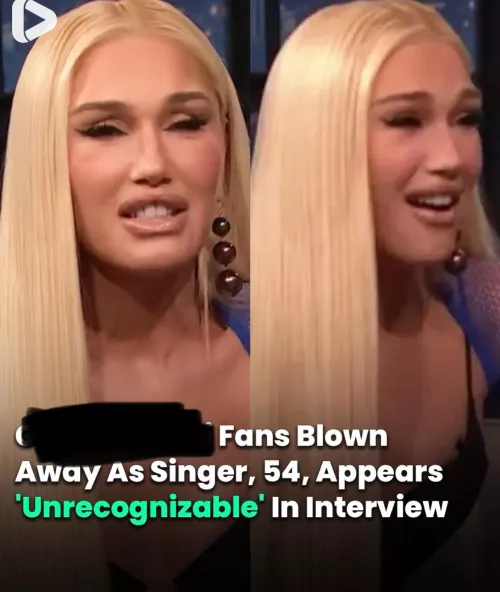 I always thought she was really beautiful so this is surprising and sad to see 