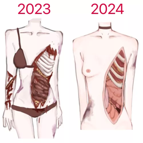 Re draw of a old guro drawing i did a year ago:3