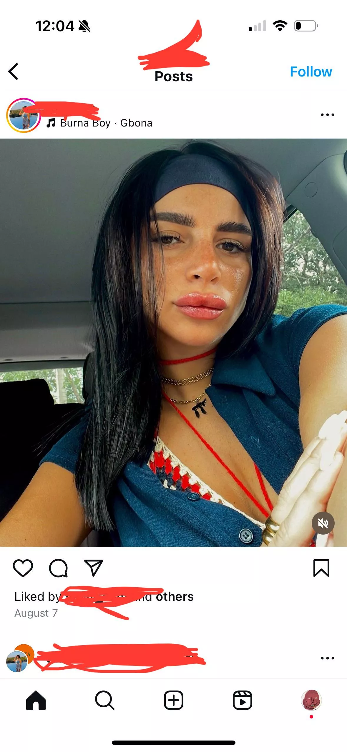 She used to have beautiful natural lips. Actually couldn’t believe it when I saw this 