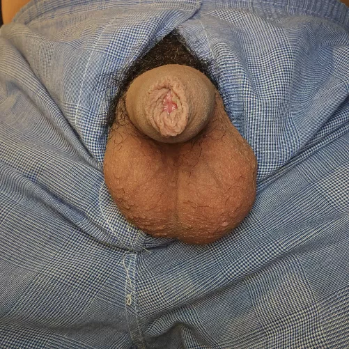 Softie, balls and bush 