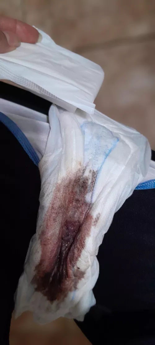 Today I woke up like this, you want to see me change 🩸🩸