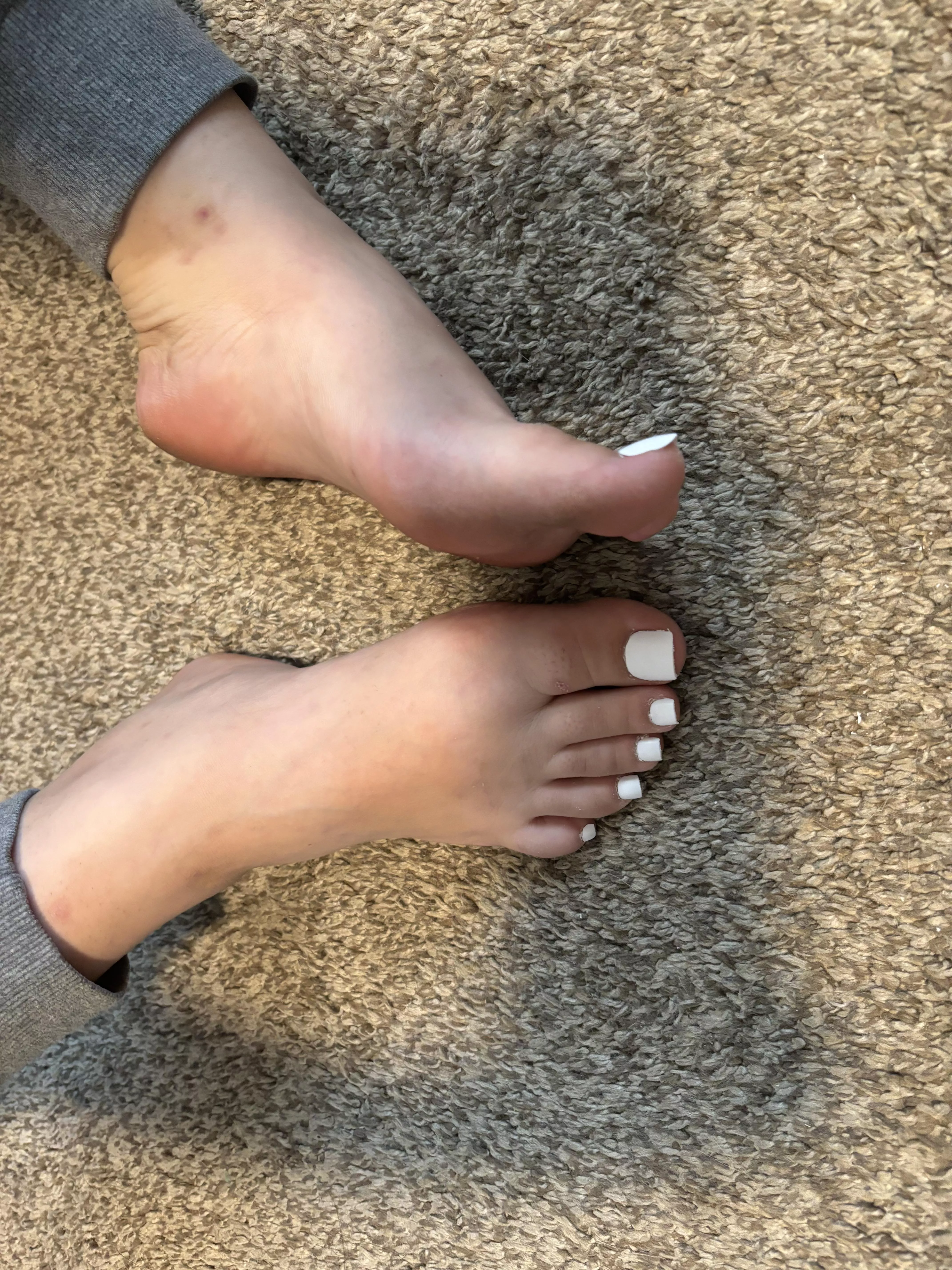 U losers wish u could kiss these