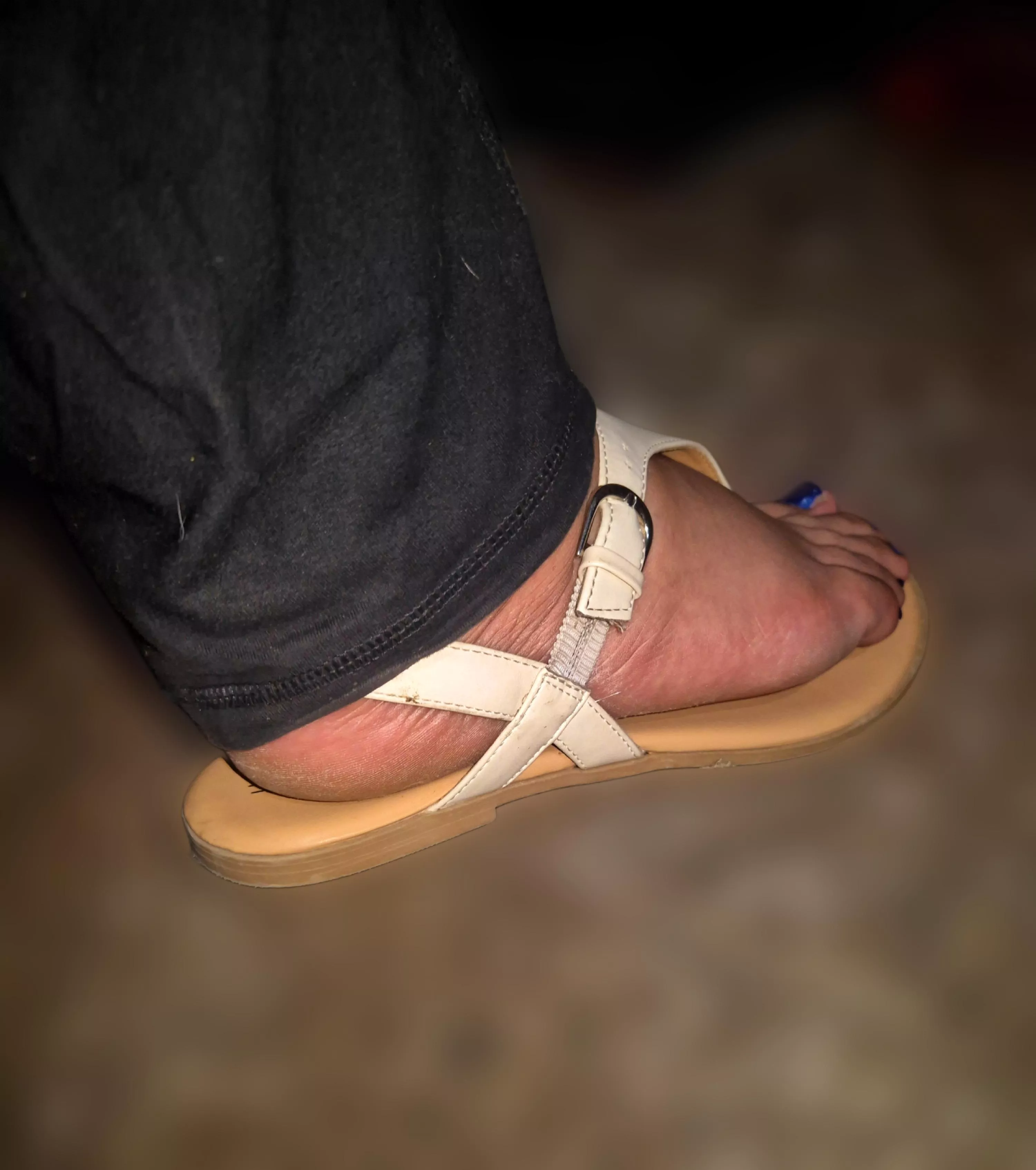 Would you like to see how my sole looks after wearing that sandal all day? 😘