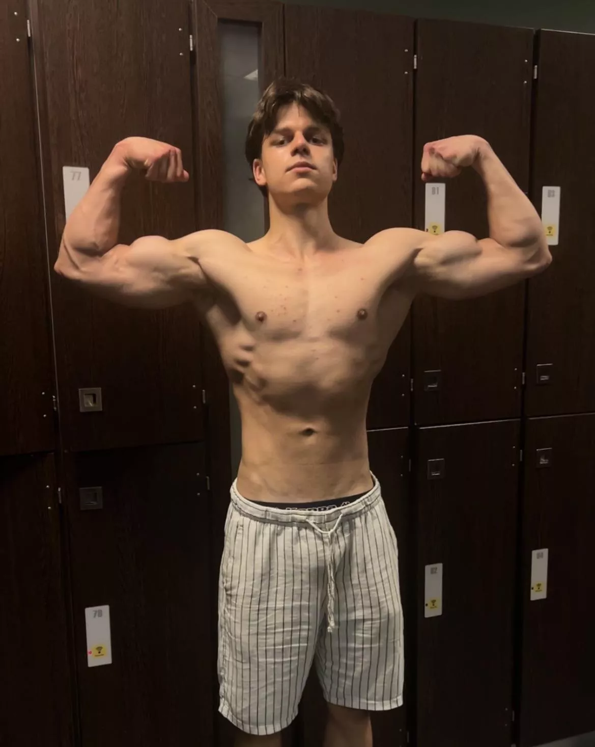 (20)Any pit sniffers?