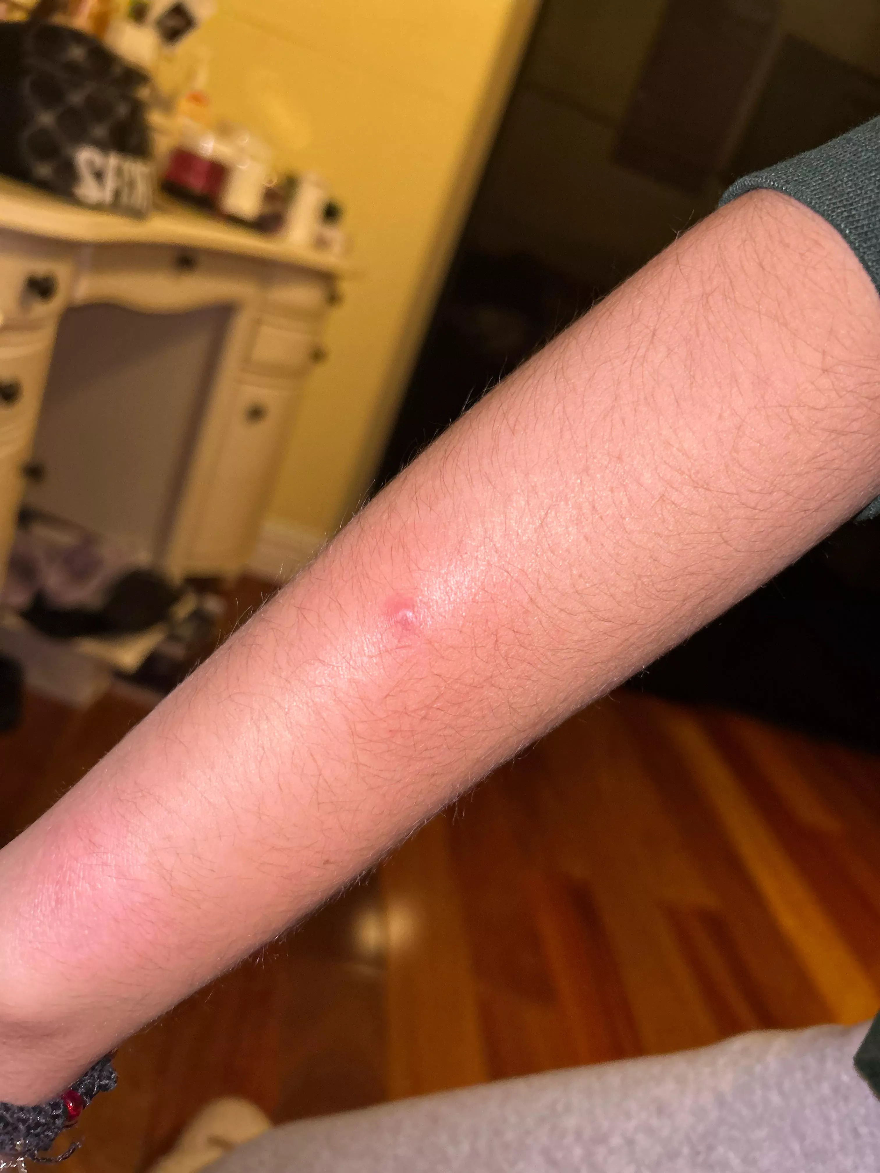 Hard warm bump on arm