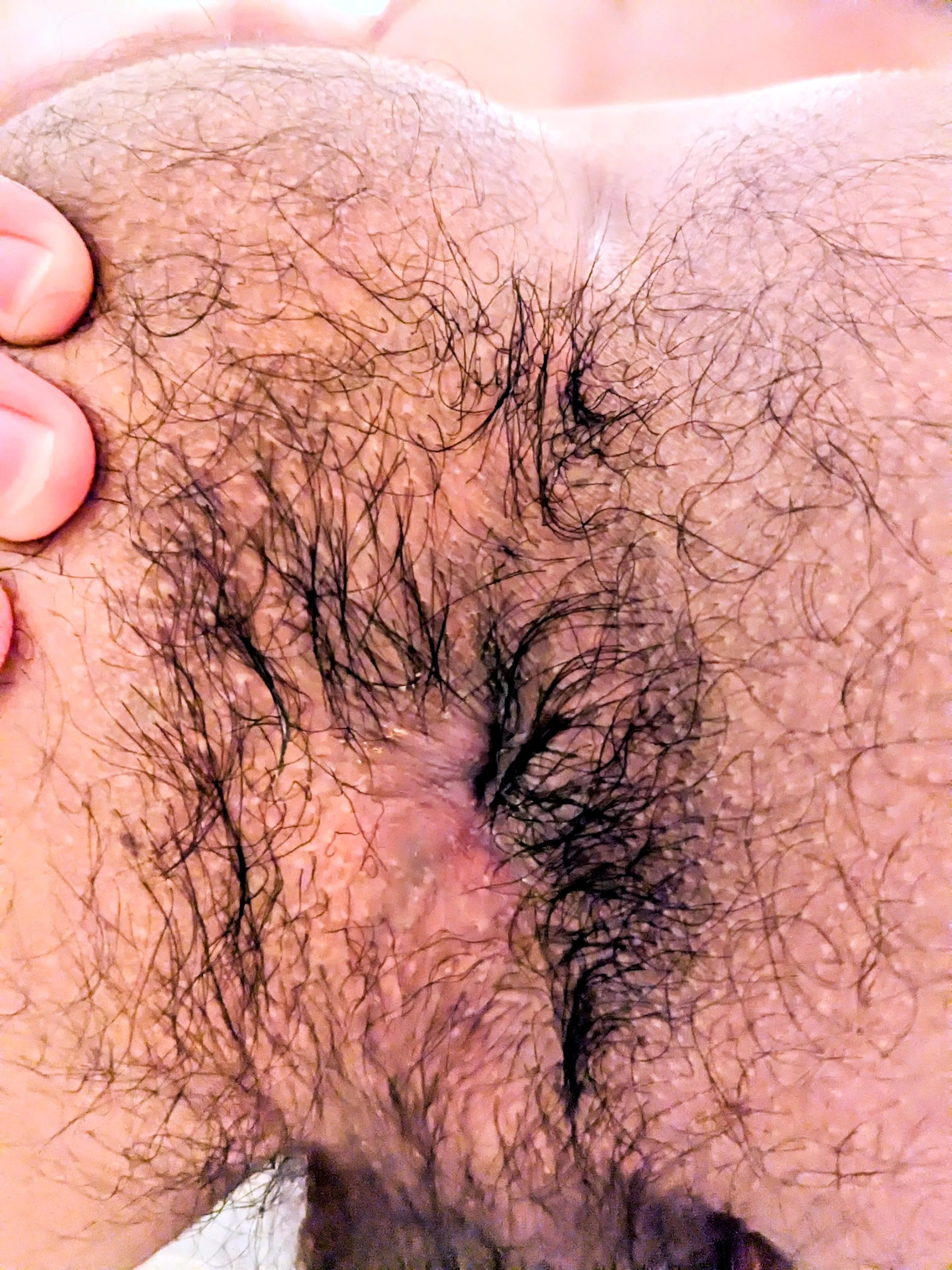 It's always the smelliest spot 