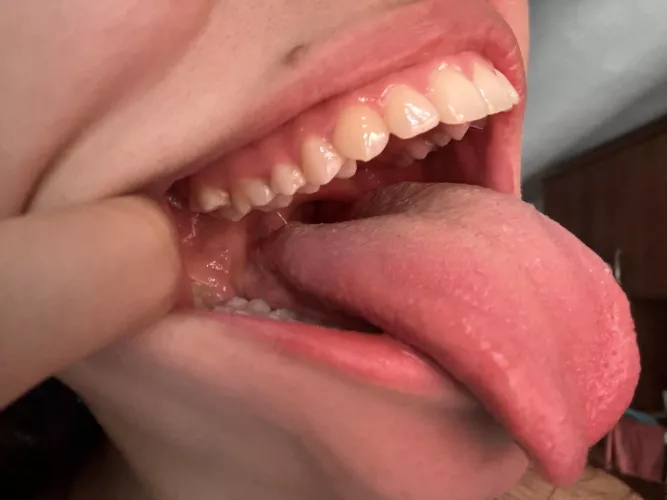 just look at those sharp teeth