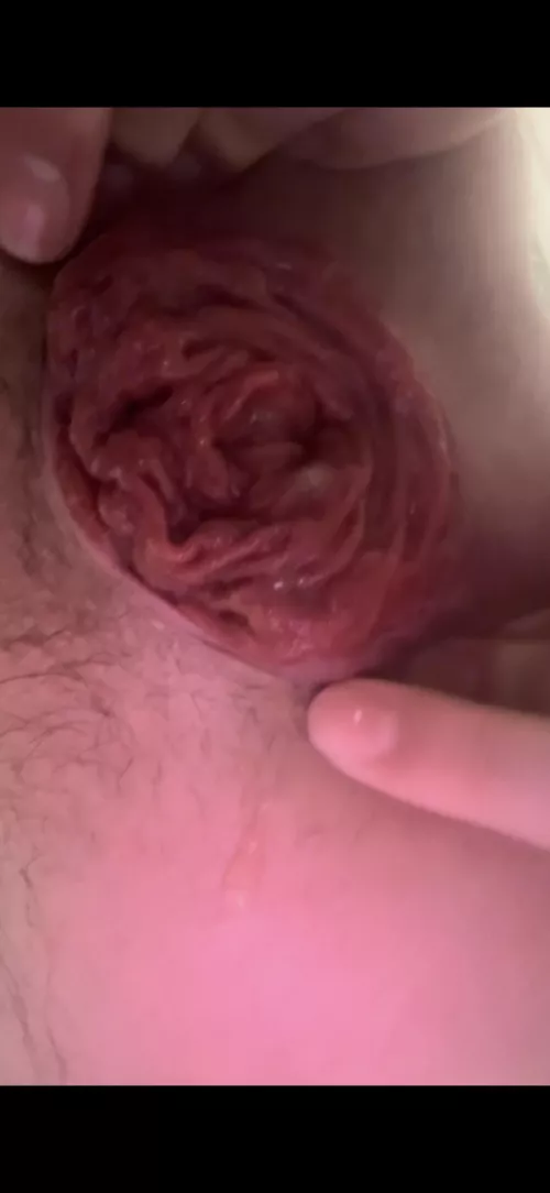 need someone to pull it out