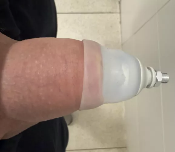 Suggestions to cover the Foreskinned Air