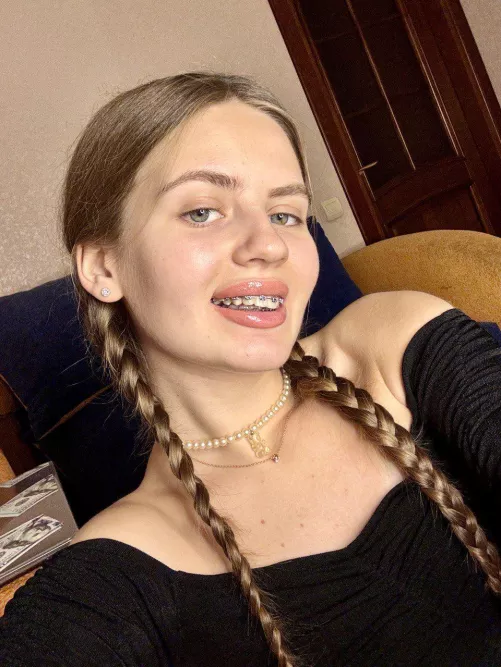 Wanna see how my braces taste? 👅