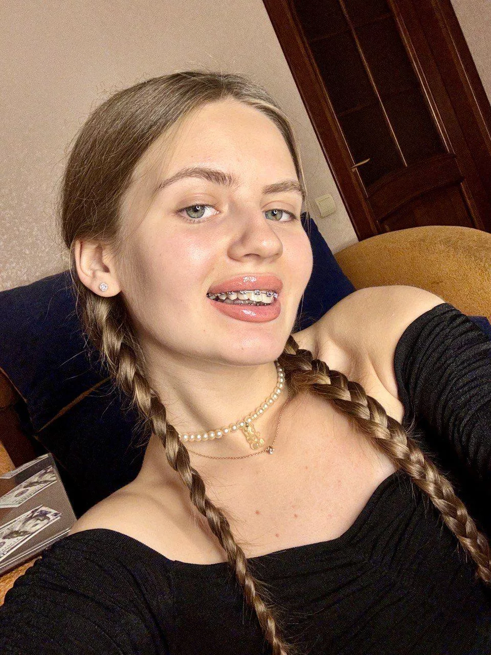 Wanna see how my braces taste? 👅