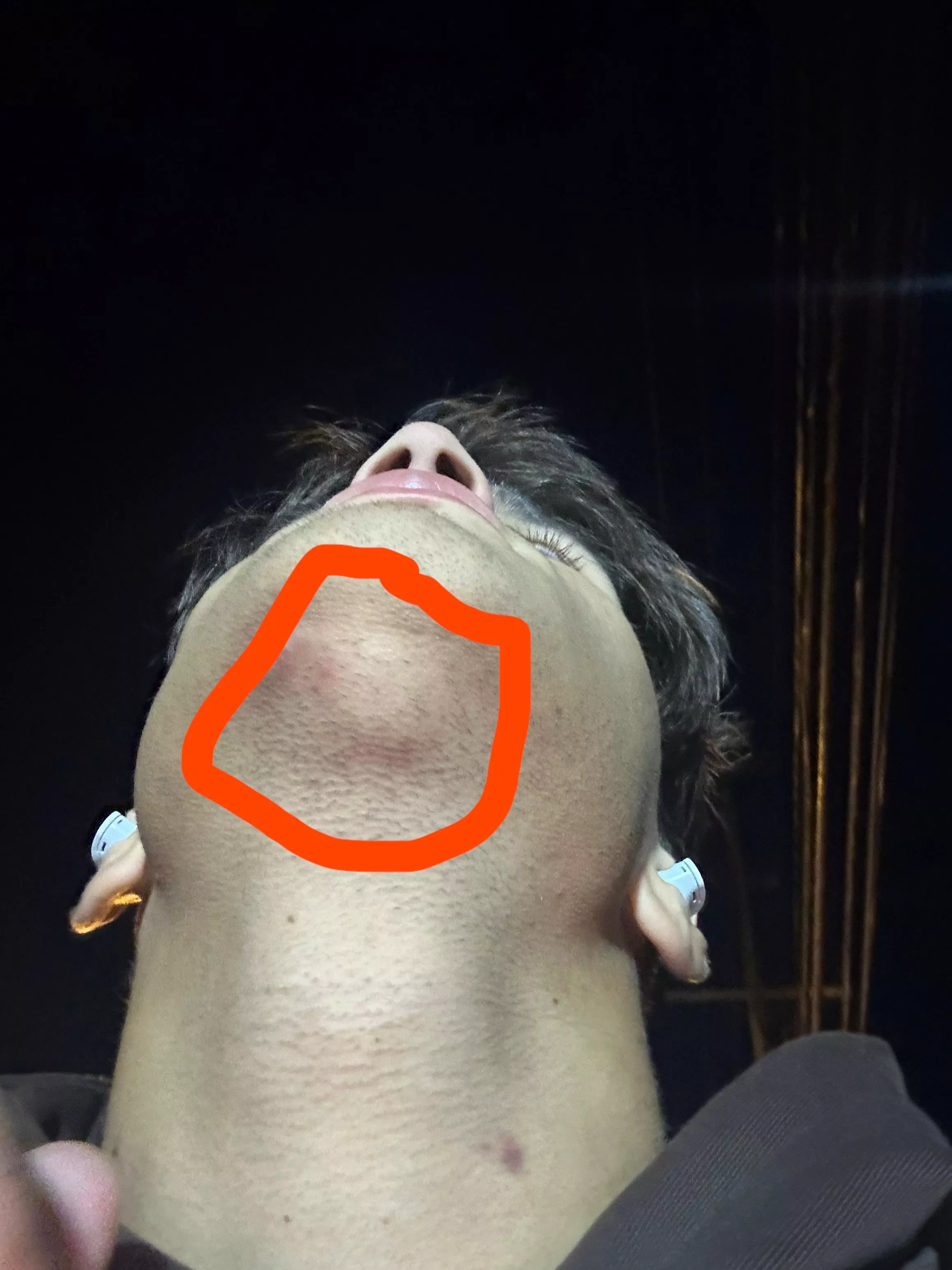 What is this lump under my jaw? Could it be a lymph node?