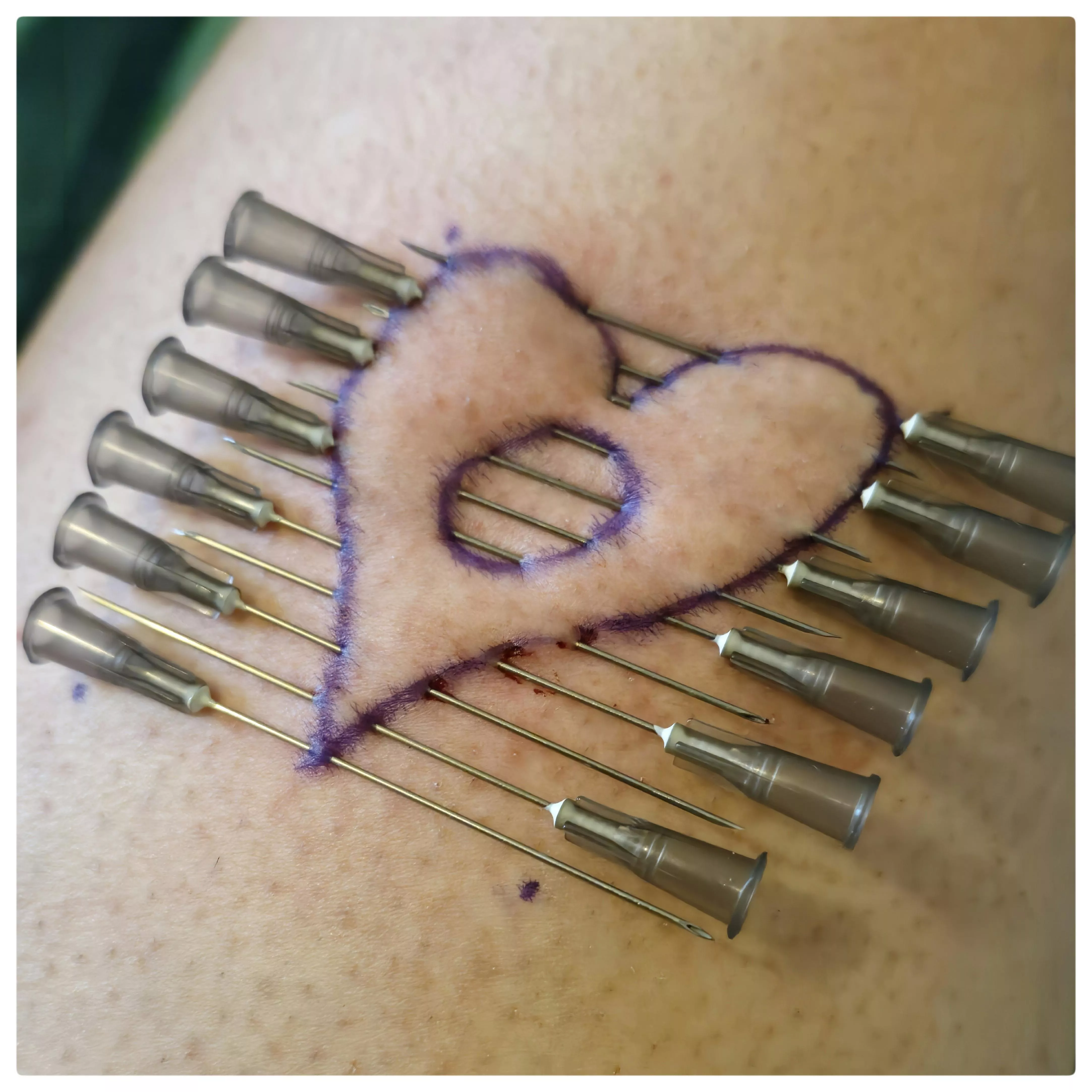 When you need(le) some love