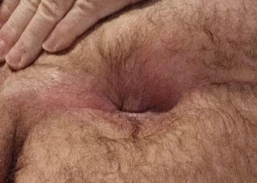 58 would you like to pop this anal cherry? 