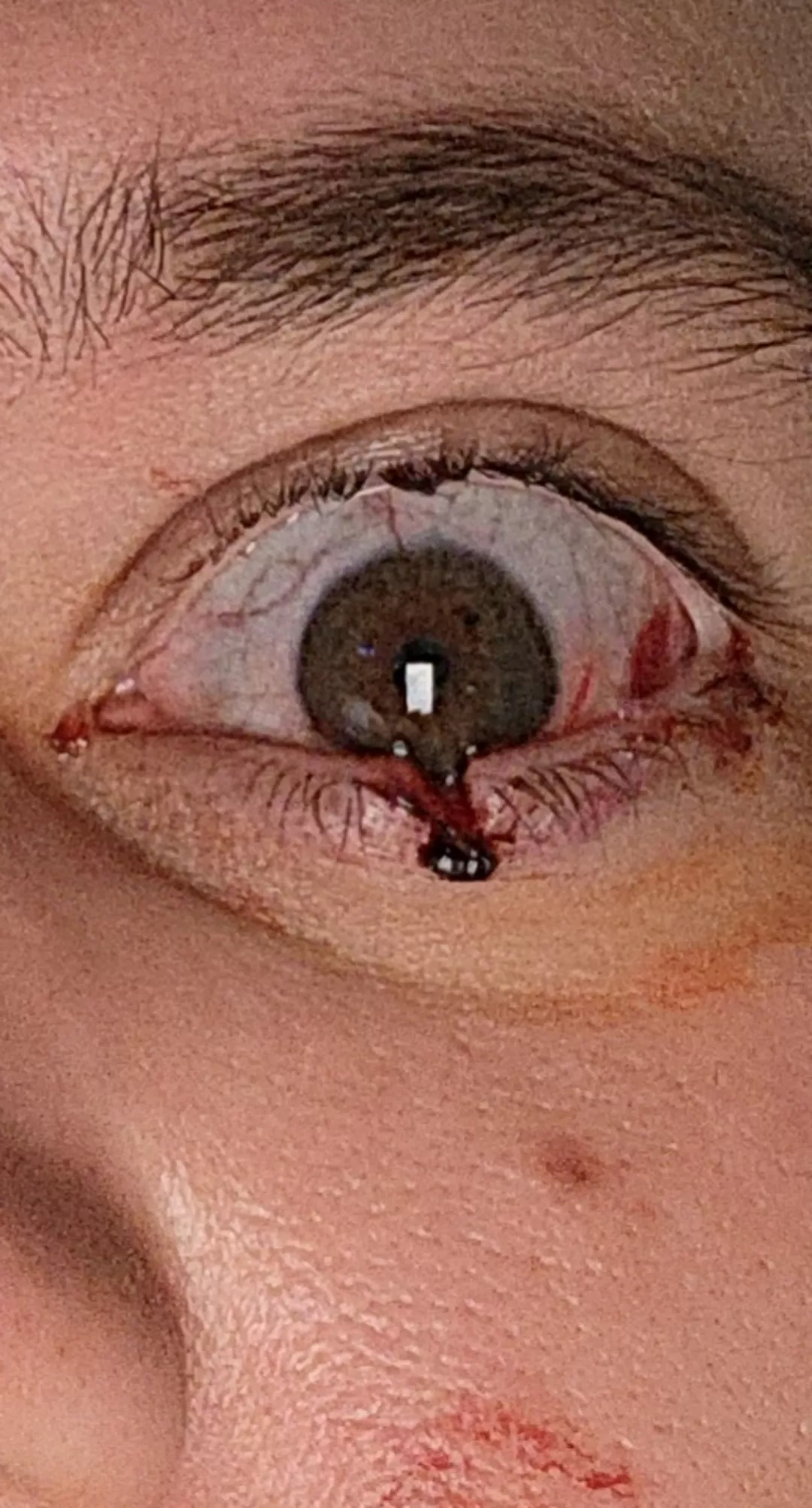 My cat cleaved open my eye
