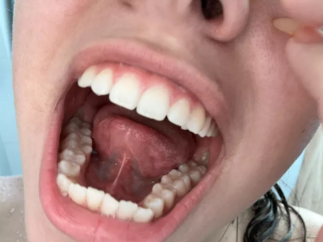 now you're going into my giant mouth