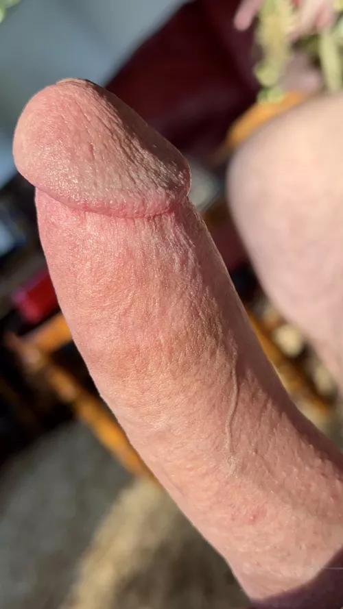 “Sun is shining in the sky” 🎶 [56]