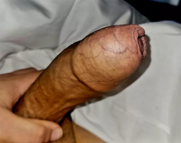 [34] still covered when hard