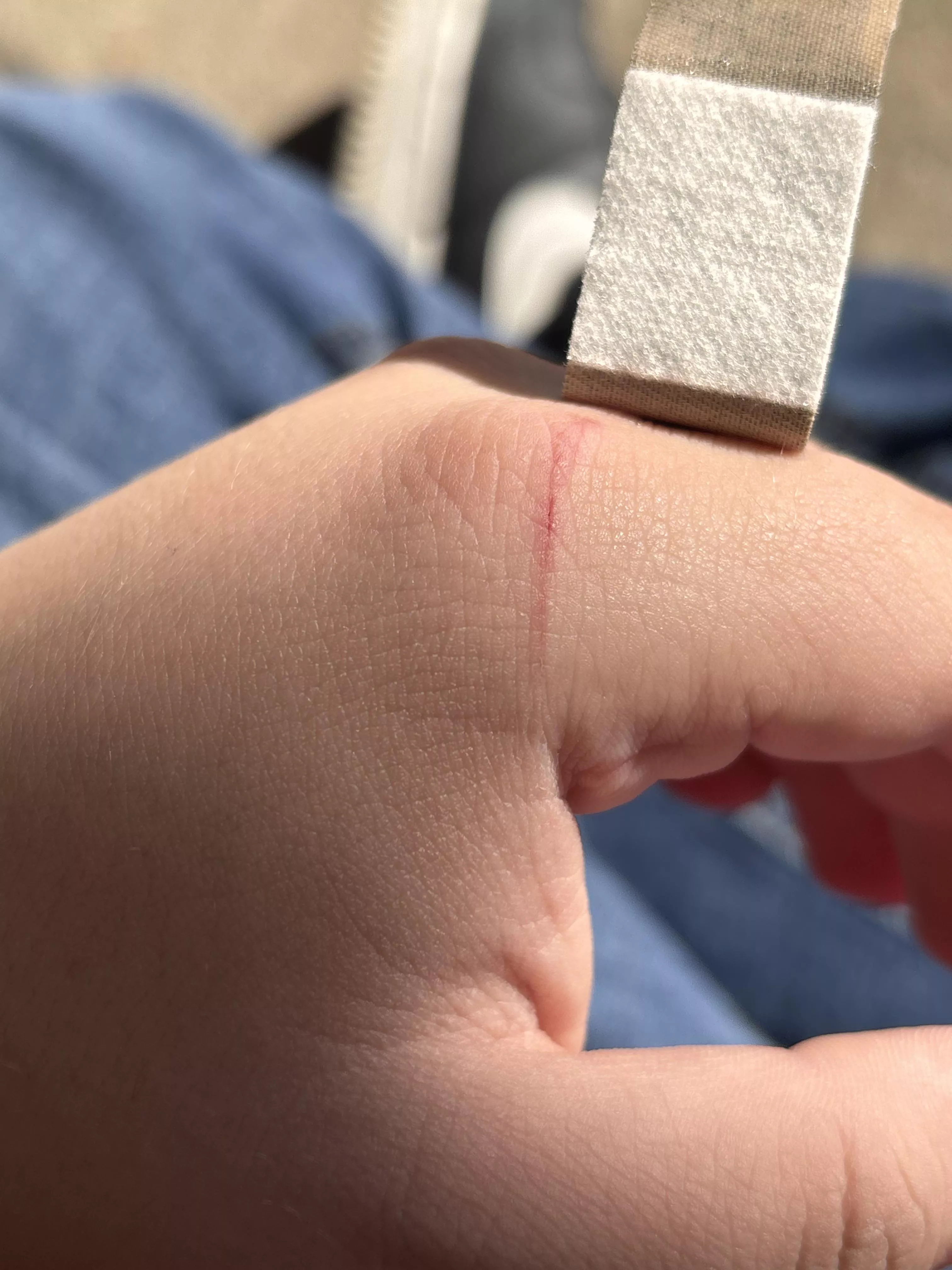 Accidently cut myself with a box cutter blade from work, could this lead to tetanus? I think I got my booster 5 or 4 years ago.