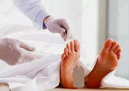 After you die, when they take you to the morgue. Do the Dr.s rest your dick ever-so-gently on your nuts? Or do they let your cock lean where gravity decides??