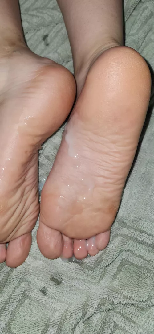 Customs now available!