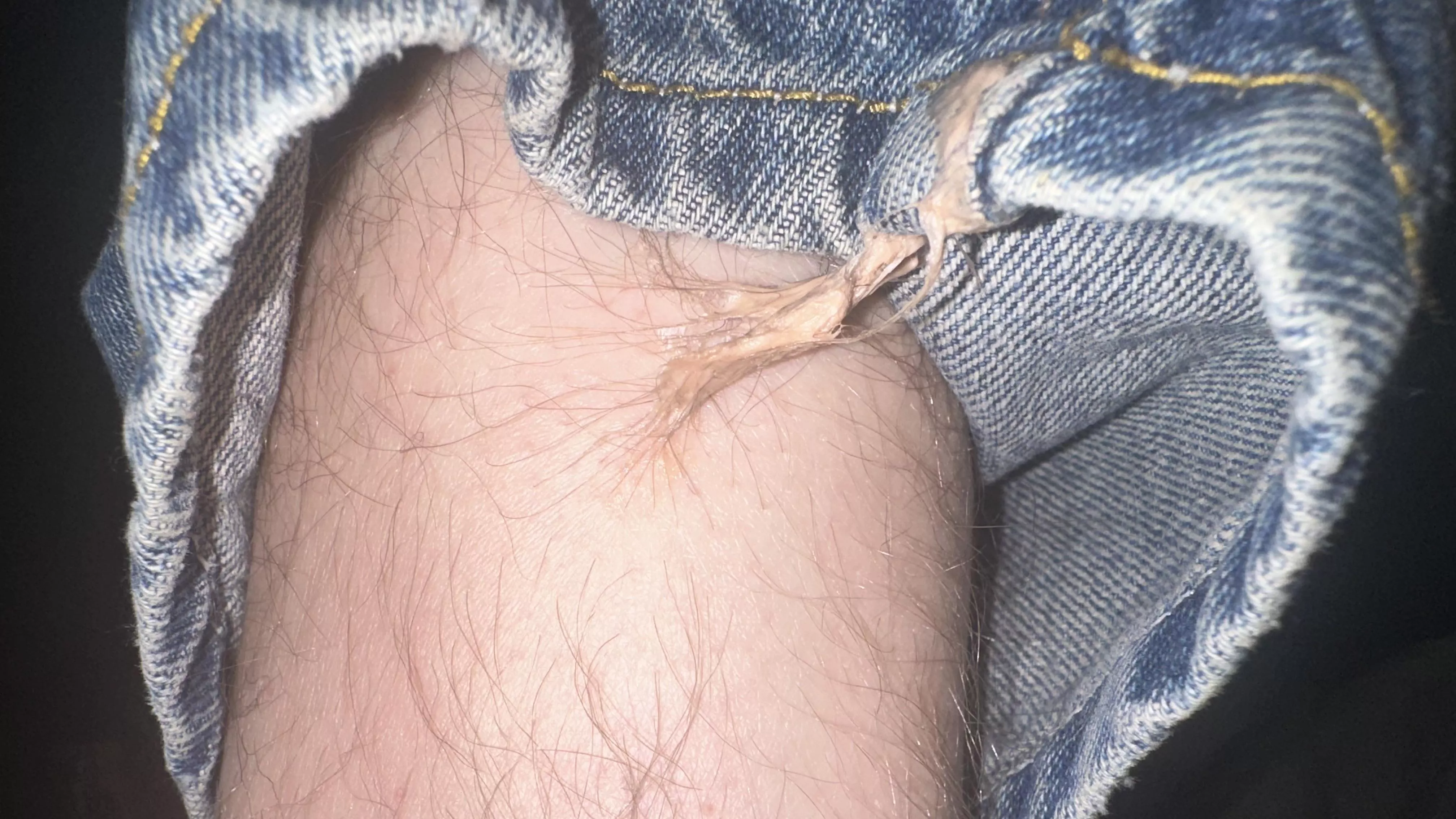 Ive experienced the worst medical accident today