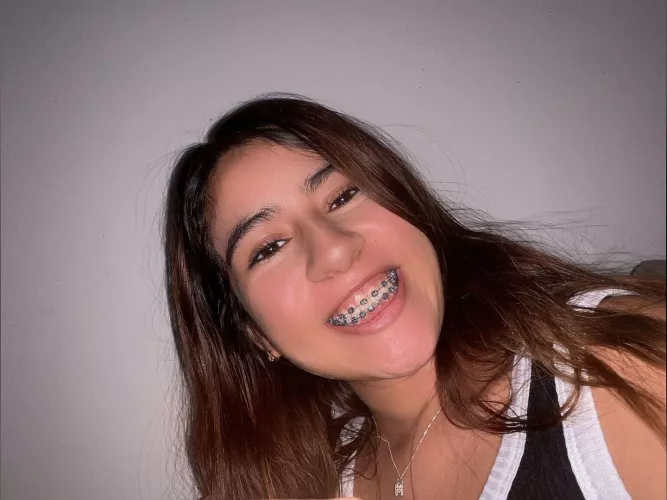 My slutty braces need more cum! Please help!