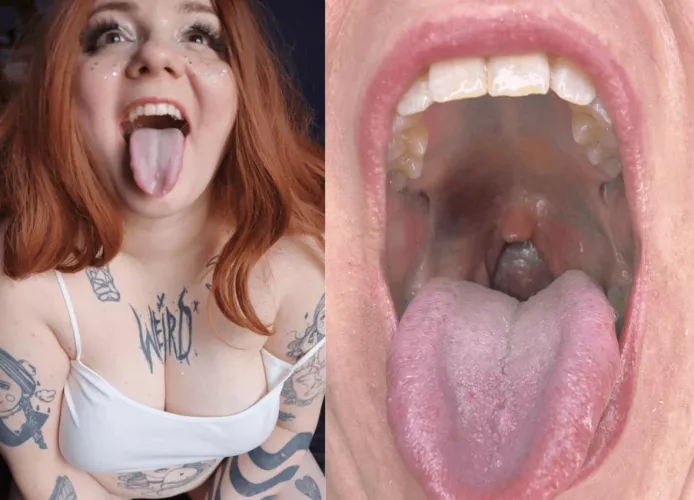 Would you volunteer to go down my throat? {f}