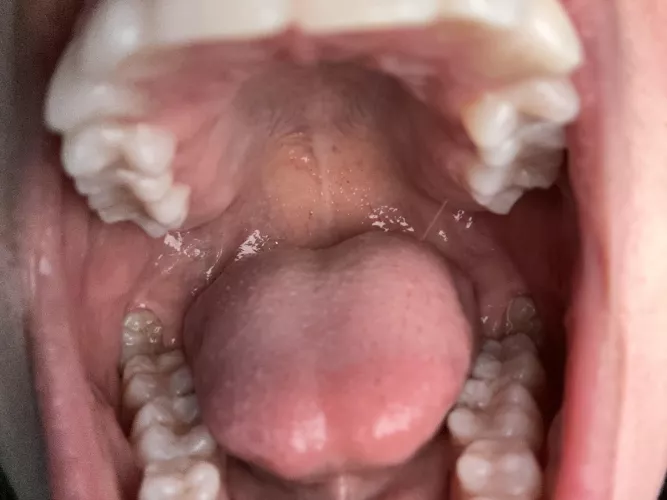 you're my favorite snack {F}