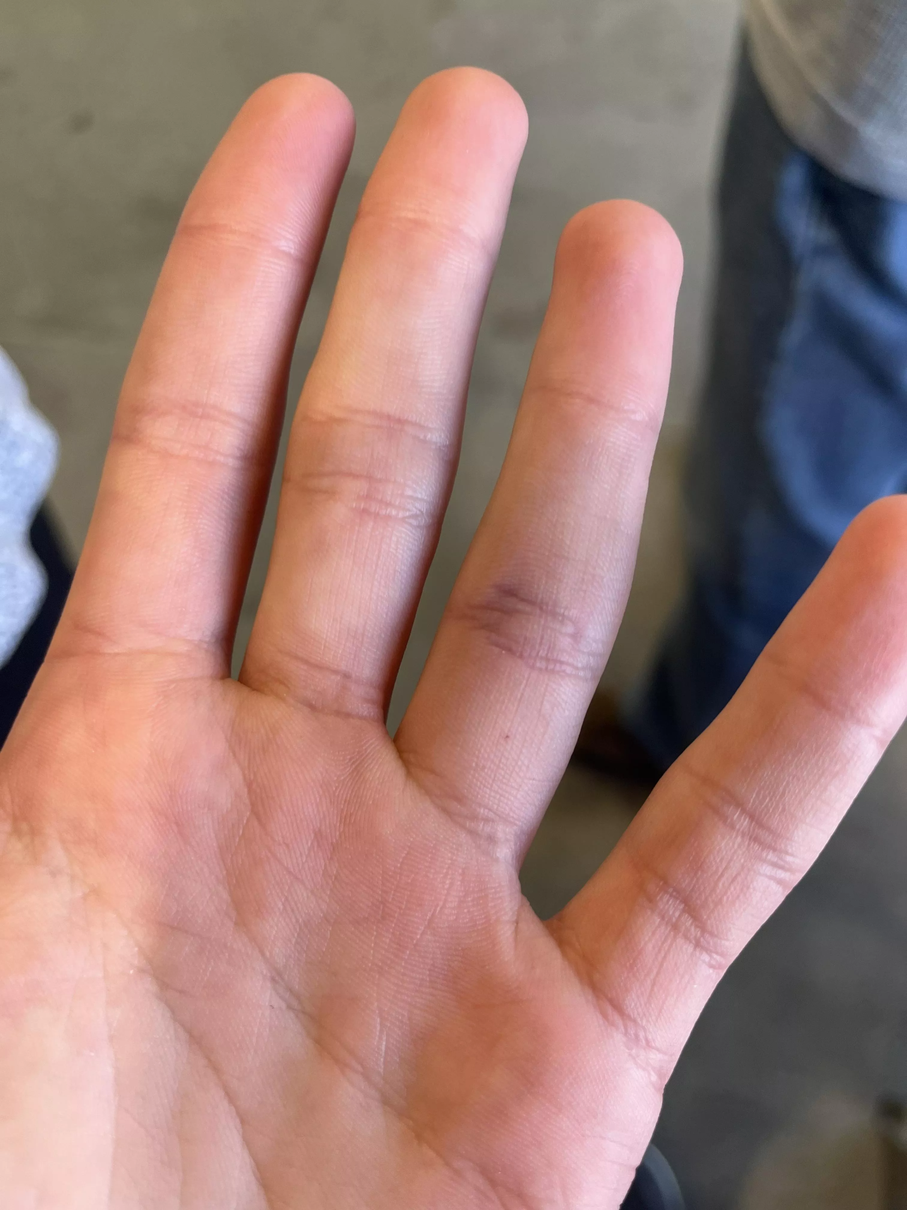 Is this bad? Happened while playing football.