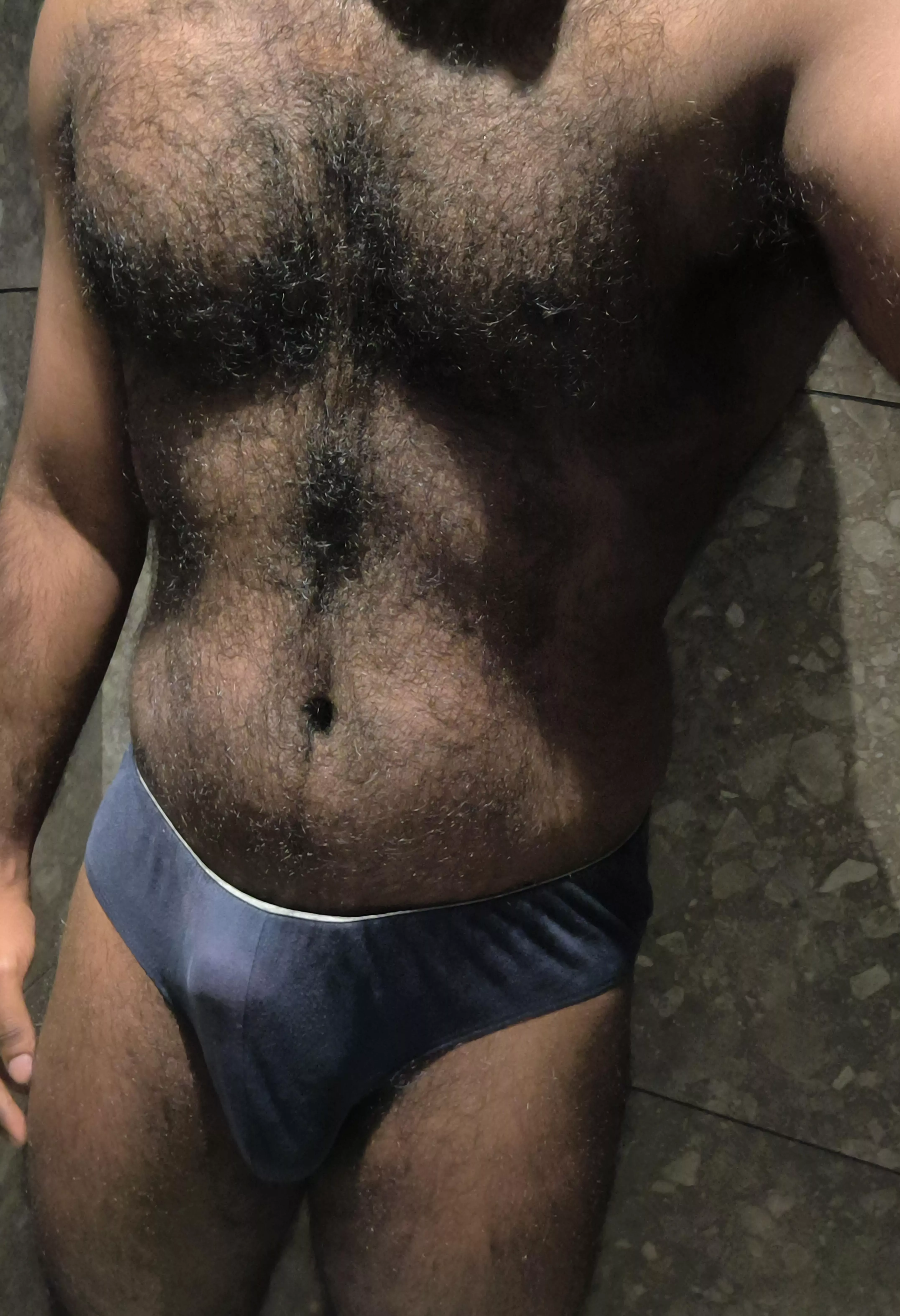 Like hairy bod?
