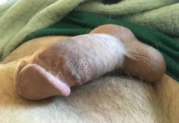 [M] Stuck in town because of weather. City Marina 