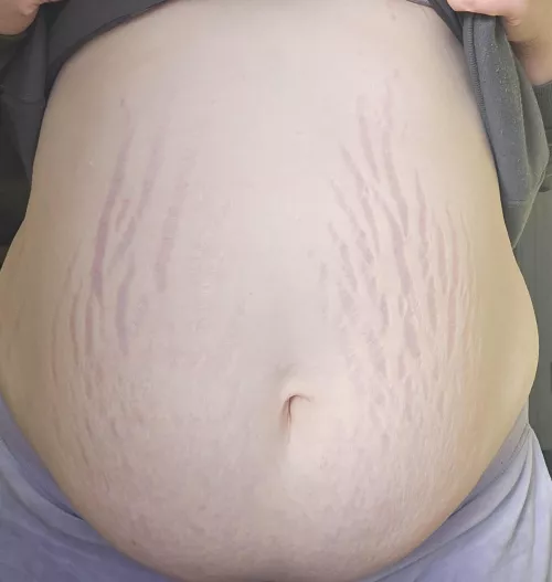 My belly is so full but I should keep eating right ? 