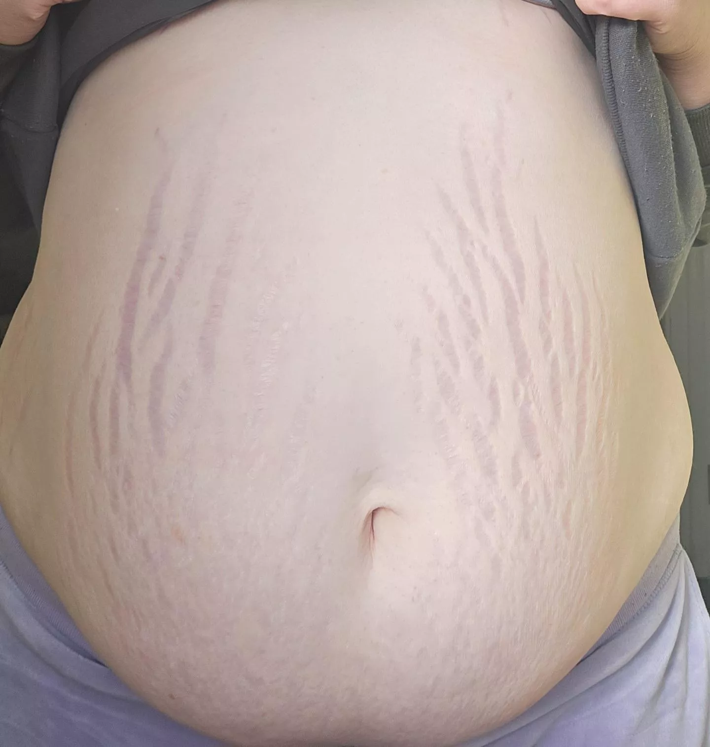 My belly is so full but I should keep eating right ? 