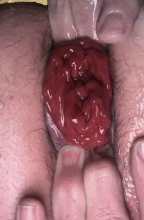 Still a work in progress