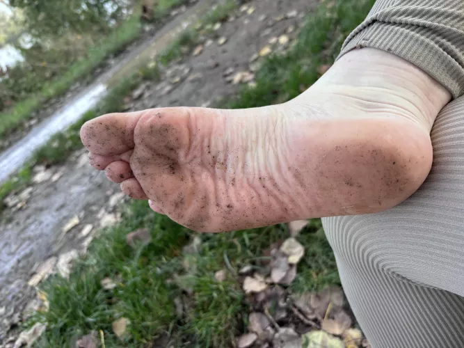 these legs and feets need attention you are ready