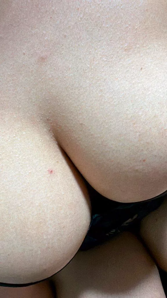 Upvote if you think I’m hot 🫣