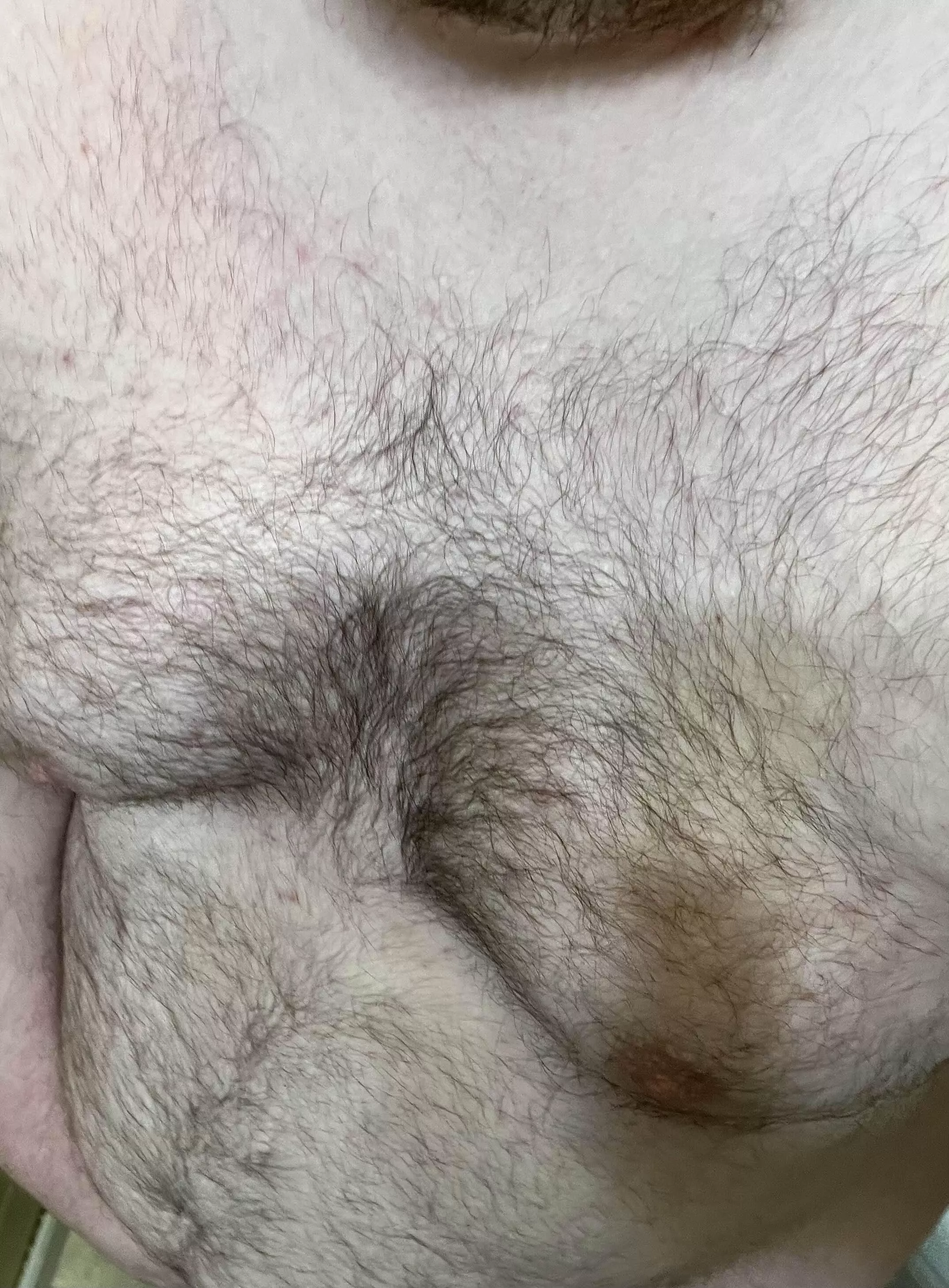 31M Was shy before, posting again 💚 