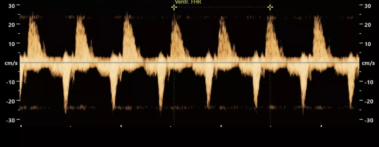 Better place to post? 