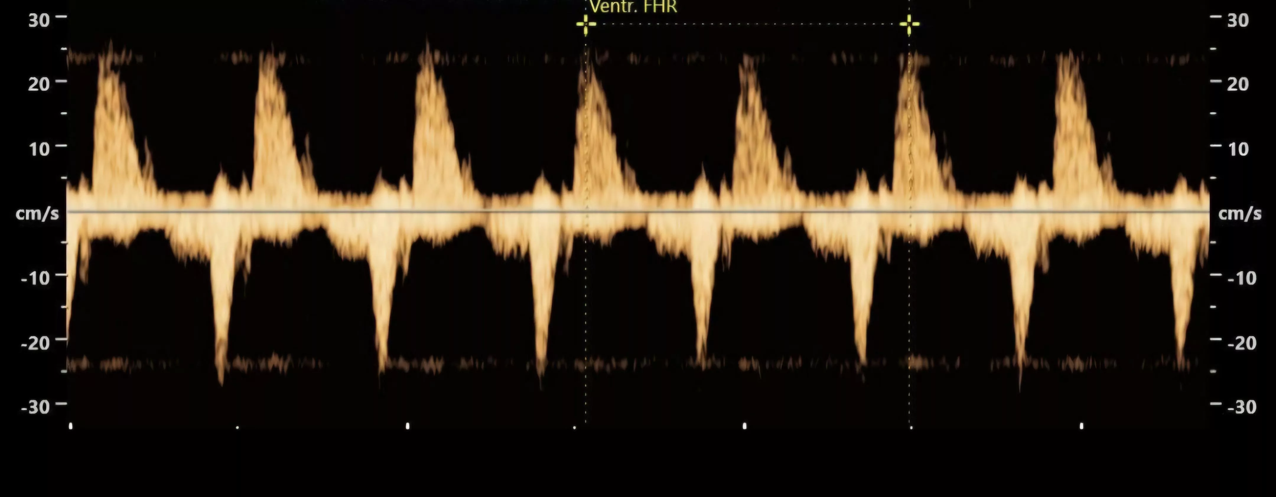 Better place to post? 