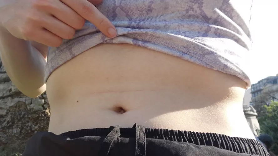 Can you clean it for me with the swab?