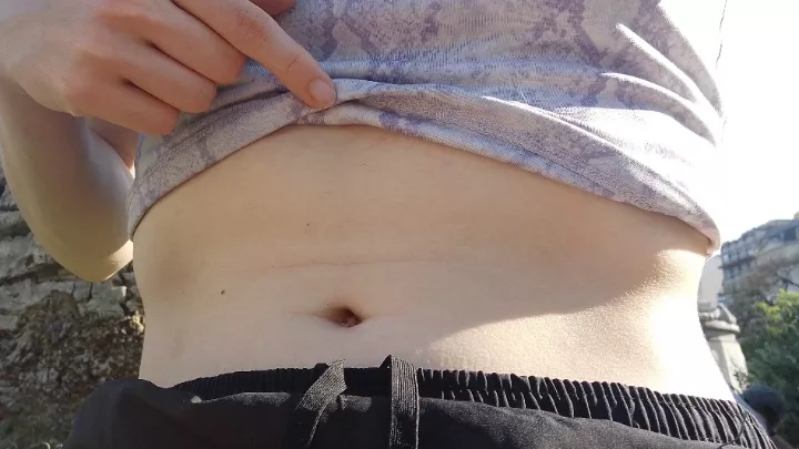 Can you clean it for me with the swab?