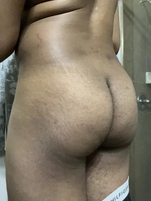 Do you like my stretch marks?